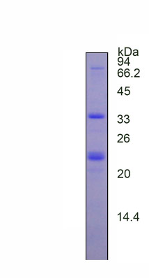 Recombinant Breast Cancer Susceptibility Protein 1 (BRCA1)