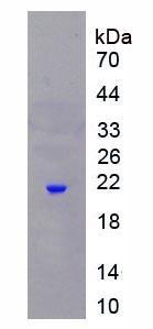 Recombinant Neutrophil gelatinase-associated lipocalin (NGAL)