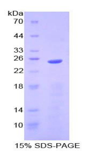 Recombinant Neutrophil gelatinase-associated lipocalin (NGAL)