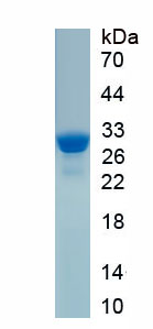 Recombinant Von Willebrand Factor A Domain Containing Protein 2 (vWA2)