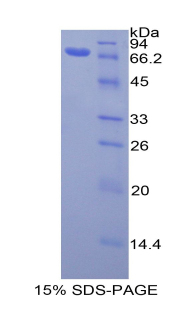 Recombinant Gamma Actin (ACTG)