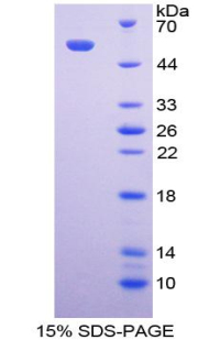 Recombinant Fc Fragment Of IgA Receptor (FcaR)