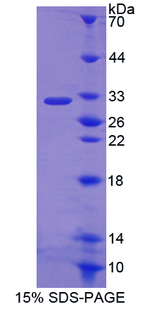 Recombinant Fc Fragment Of IgA Receptor (FcaR)