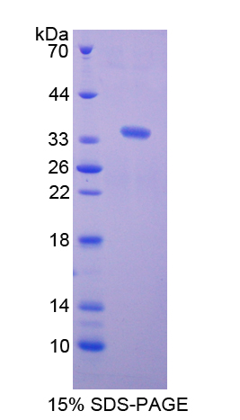 Recombinant Complement Component 1, Q Receptor (C1qR1)