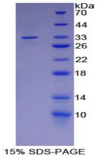 Recombinant Lipopolysaccharide Binding Protein (LBP)