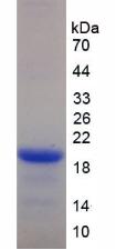 Recombinant Killer Cell Lectin Like Receptor Subfamily D, Member 1 (KLRD1)
