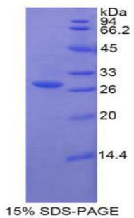 Recombinant Glucuronidase Beta (GUSb)