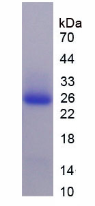 Recombinant Interferon Alpha/Beta Receptor 1 (IFNa/bR1)