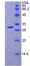 Recombinant Interferon Alpha/Beta Receptor 1 (IFNa/bR1)