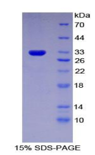 Recombinant Interferon Alpha/Beta Receptor 1 (IFNa/bR1)