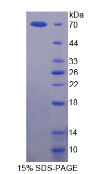 Recombinant Semaphorin 4D (SEMA4D)