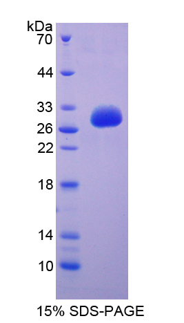 Recombinant Immunoglobulin Superfamily, Member 2 (IGSF2)