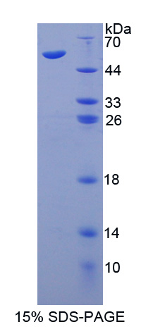 Recombinant Immunoglobulin Superfamily, Member 2 (IGSF2)