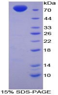 Recombinant Enolase 3 (ENO3)