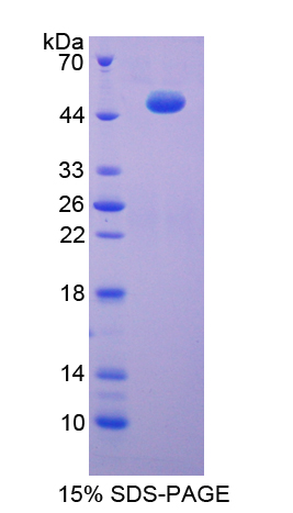 Recombinant Enolase 3 (ENO3)