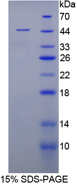 Recombinant Enolase 3 (ENO3)