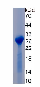 Recombinant Proteinase 3 (PR3)