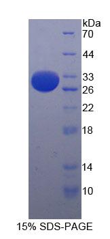 Recombinant Integrin Alpha E (ITGaE)