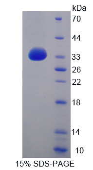 Recombinant Integrin Beta 4 (ITGb4)