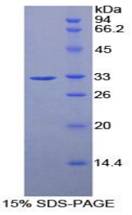 Recombinant Ribonuclease Inhibitor (RI)