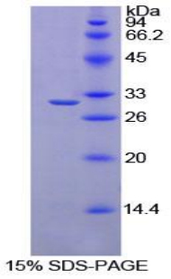 Recombinant Ribonuclease Inhibitor (RI)