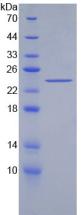 Recombinant Acetylcholinesterase (ACHE)