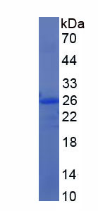 Recombinant Acetylcholinesterase (ACHE)