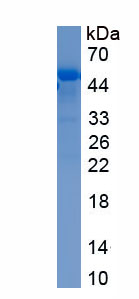 Recombinant Enolase 1 (ENO1)