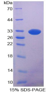 Recombinant Pancreatic Lipase (PL)