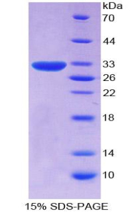 Recombinant Cluster Of Differentiation 109 (CD109)