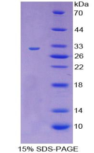 Recombinant Cluster Of Differentiation 109 (CD109)