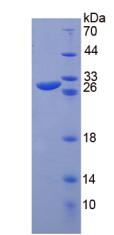 Recombinant Chitinase-3-like Protein 1 (CHI3L1)