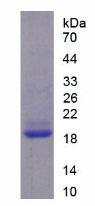 Recombinant Lysosomal Associated Membrane Protein 2 (LAMP2)