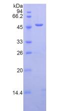 Recombinant Lysosomal Associated Membrane Protein 2 (LAMP2)