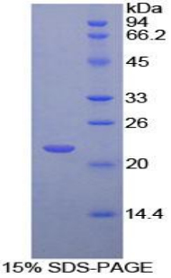 Recombinant Thrombopoietin Receptor (TPOR)