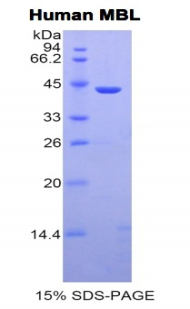 Recombinant Mannose Binding Lectin (MBL)