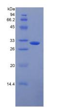 Recombinant Mannose Binding Lectin (MBL)