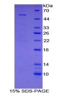 Recombinant Mannose Binding Lectin (MBL)