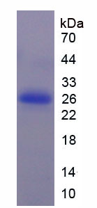 Recombinant Colony Stimulating Factor Receptor, Macrophage (MCSFR)