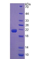 Recombinant Calreticulin (CALR)