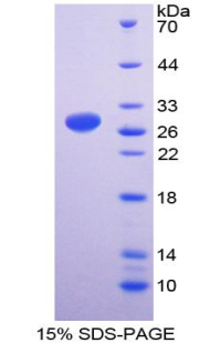 Recombinant Interferon Gamma Receptor 1 (IFNgR1)