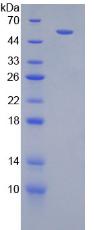 Recombinant Interferon Gamma Receptor 1 (IFNgR1)