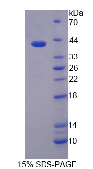 Recombinant Sorbitol Dehydrogenase (SDH)