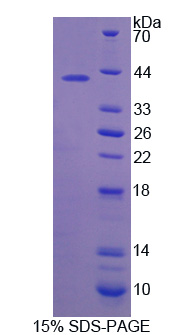 Recombinant Sorbitol Dehydrogenase (SDH)