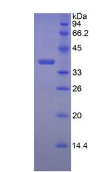 Recombinant Lumican (LUM)