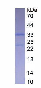 Recombinant Endoplasmic Reticulum Resident Protein 57 (ERp57)