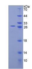 Recombinant Tumor Necrosis Factor Receptor 1 (TNFR1)