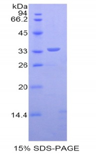 Recombinant Dystrophin (DMD)