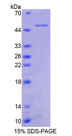 Recombinant Tumor Necrosis Factor Receptor Superfamily, Member 1B (TNFRSF1B)