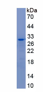 Recombinant Killer Cell Immunoglobulin Like Receptor 2DL1 (KIR2DL1)